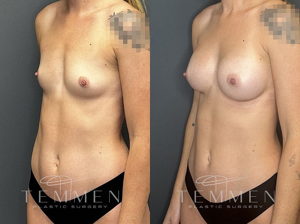 Before and after plastic surgery transformation.