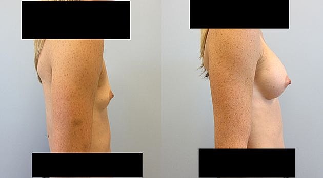 Comparison of two body side profiles.