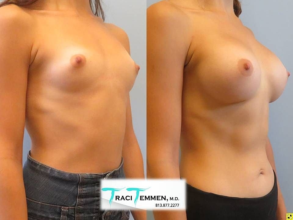 Before and after body transformation showcase.