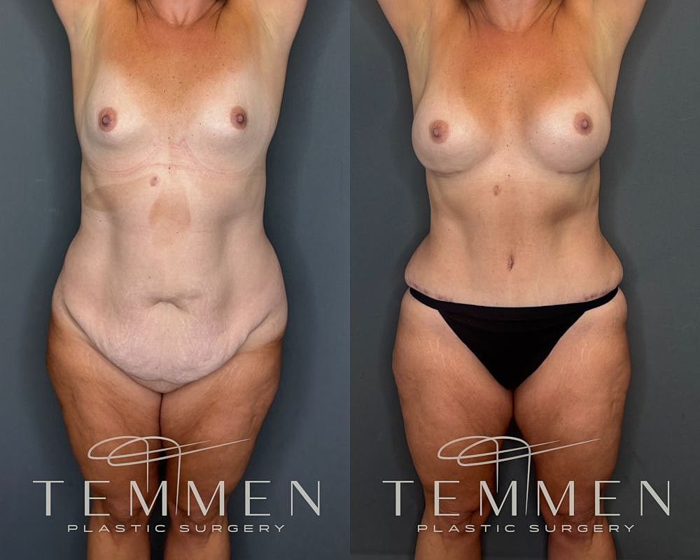 Before and after plastic surgery transformation image.