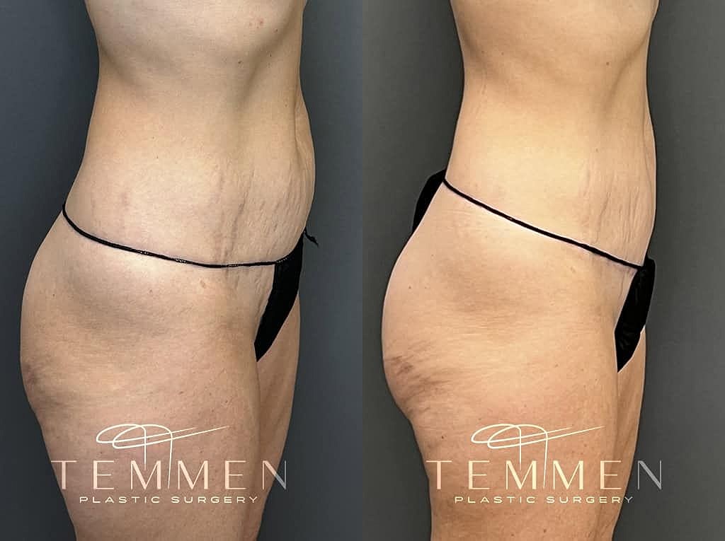 Before and after plastic surgery results comparison.