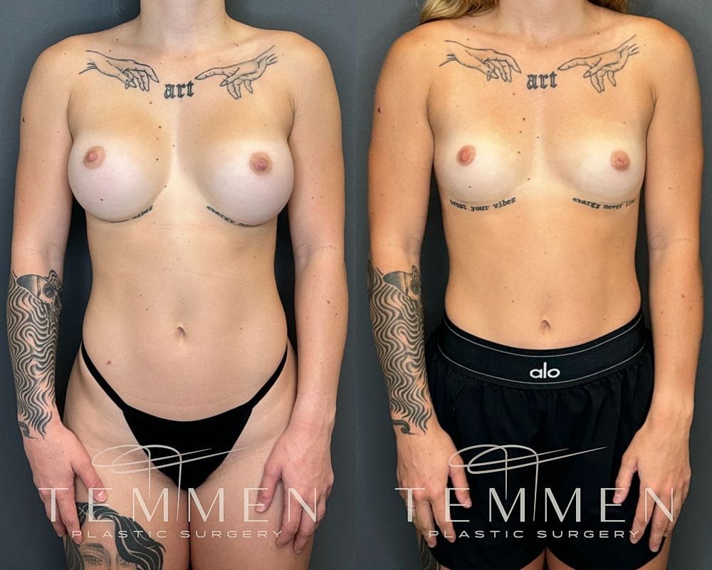 Before and after plastic surgery transformation.