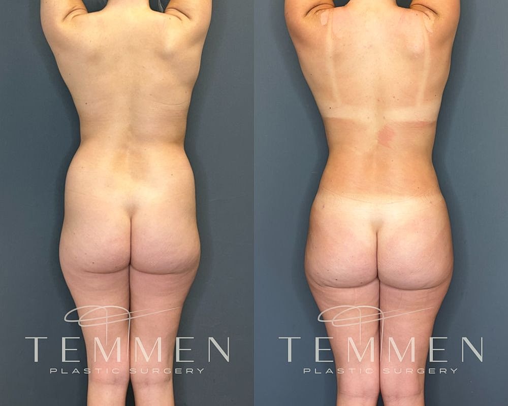 Before and after plastic surgery results comparison.