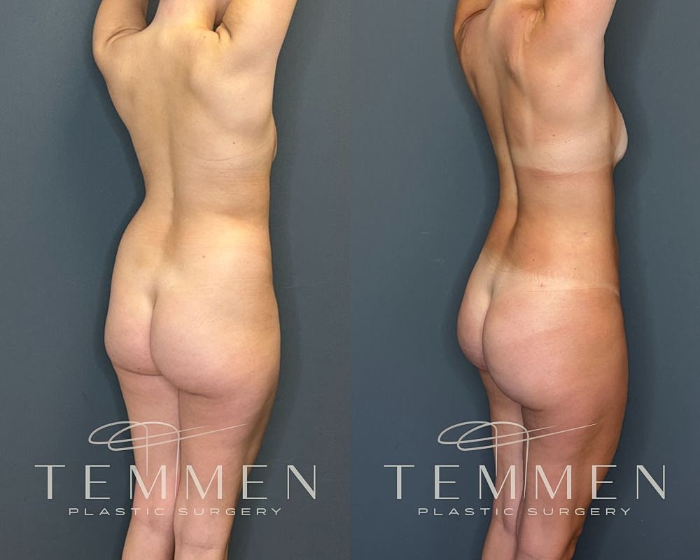 Before and after plastic surgery transformation.