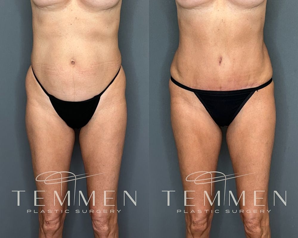 Before and after plastic surgery transformation.