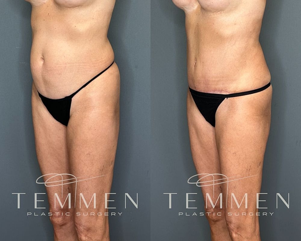 Before and after plastic surgery treatment photos.